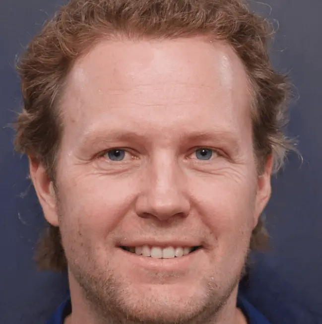 striction d review 3